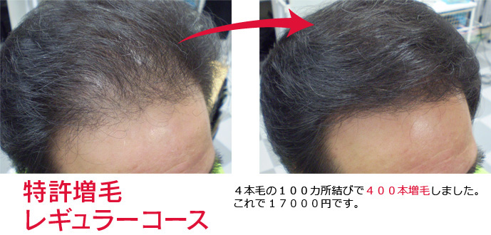 増毛技術結んで増やす増毛法